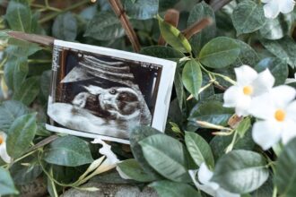 découvrez les bienfaits de l'accouchement naturel, une méthode respectueuse du corps et de l'esprit qui favorise un processus de naissance harmonieux. informez-vous sur les techniques, les préparations et les avantages de cette approche pour vivre une expérience unique et empowering.