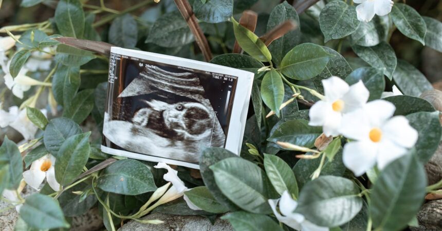 découvrez les bienfaits de l'accouchement naturel, une méthode respectueuse du corps et de l'esprit qui favorise un processus de naissance harmonieux. informez-vous sur les techniques, les préparations et les avantages de cette approche pour vivre une expérience unique et empowering.