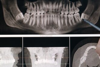 découvrez l'orthodontie, une spécialité dentaire qui corrige les malpositions des dents et des mâchoires pour un sourire harmonieux et une meilleure santé bucco-dentaire. nos experts vous accompagnent dans votre parcours vers un alignement parfait.