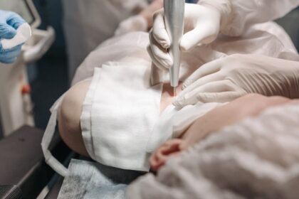 découvrez la chirurgie dermatologique : une spécialité médicale dédiée au diagnostic et au traitement des affections cutanées. apprenez-en plus sur les procédures, avantages et soins post-opératoires.