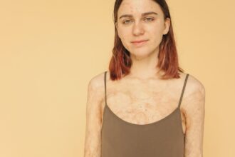 découvrez l'impact des cicatrices sur la peau et l'esprit, ainsi que des conseils pour leur traitement et leur gestion. apprenez à embrasser votre histoire tout en préservant votre beauté.