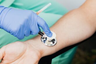 découvrez comment améliorer votre circulation sanguine pour une meilleure santé globale. apprenez des astuces, des exercices et des conseils nutritionnels pour stimuler votre circulation et prévenir les problèmes de santé.