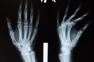 découvrez les enjeux et solutions liés à la déformation des joints. apprenez comment identifier et traiter les problèmes de déformation dans les constructions pour garantir la durabilité et la sécurité des structures.
