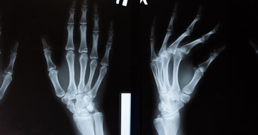 découvrez les enjeux et solutions liés à la déformation des joints. apprenez comment identifier et traiter les problèmes de déformation dans les constructions pour garantir la durabilité et la sécurité des structures.