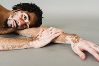 découvrez tout ce qu'il faut savoir sur la dépigmentation, ses causes, ses traitements et les meilleures pratiques pour une peau éclatante et uniforme. informez-vous sur les solutions efficaces et les précautions à prendre pour préserver la santé de votre épiderme.