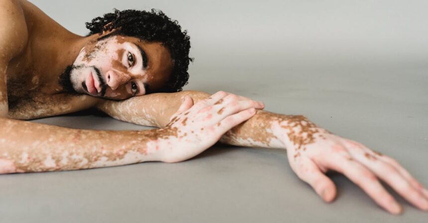 découvrez tout ce qu'il faut savoir sur la dépigmentation, ses causes, ses traitements et les meilleures pratiques pour une peau éclatante et uniforme. informez-vous sur les solutions efficaces et les précautions à prendre pour préserver la santé de votre épiderme.