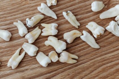 découvrez tout sur la gingivite : causes, symptômes, traitements et conseils de prévention pour maintenir une bonne santé bucco-dentaire. informez-vous sur cette inflammation des gencives et protégez votre sourire.