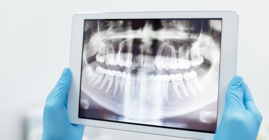 découvrez tout ce que vous devez savoir sur la parodontite, une affection dentaire courante mais sérieuse. apprenez les causes, les symptômes et les traitements disponibles pour préserver votre santé bucco-dentaire.