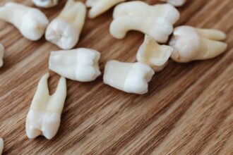 découvrez tout ce qu'il faut savoir sur l'extraction dentaire : étapes, soins post-opératoires et conseils pour une guérison rapide. notre guide vous aide à comprendre ce procédé courant et à apaiser vos craintes.