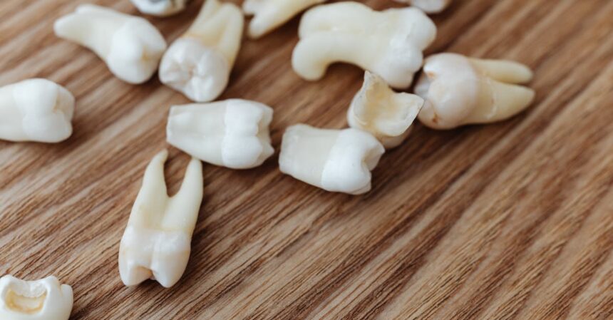 découvrez tout ce qu'il faut savoir sur l'extraction dentaire : étapes, soins post-opératoires et conseils pour une guérison rapide. notre guide vous aide à comprendre ce procédé courant et à apaiser vos craintes.