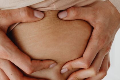 découvrez tout ce que vous devez savoir sur les vergetures : causes, prévention et traitements efficaces. apprenez à prendre soin de votre peau et à minimiser l'apparence des vergetures pour une confiance retrouvée.