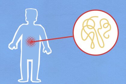 découvrez ce qu'est l'inflammation, ses causes et ses effets sur le corps. apprenez comment cette réponse immunitaire peut être à la fois protectrice et nuisible, ainsi que les traitements et stratégies pour la gérer efficacement.