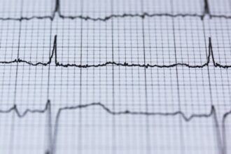 découvrez les méthodes de diagnostic de l'insuffisance cardiaque, y compris les examens cliniques, les tests d'imagerie et les analyses sanguines. apprenez à reconnaître les symptômes et à agir rapidement pour une meilleure prise en charge de votre santé cardiaque.