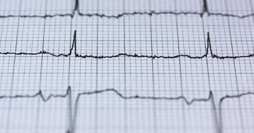 découvrez les méthodes de diagnostic de l'insuffisance cardiaque, y compris les examens cliniques, les tests d'imagerie et les analyses sanguines. apprenez à reconnaître les symptômes et à agir rapidement pour une meilleure prise en charge de votre santé cardiaque.