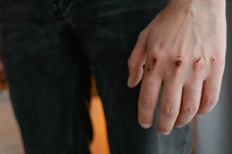 découvrez les causes courantes de la douleur aux doigts, les symptômes associés et les traitements efficaces pour soulager votre inconfort. apprenez comment prévenir les douleurs et maintenir la santé de vos articulations.