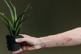 découvrez tout sur l'eczéma, ses causes, symptômes et traitements. apprenez à gérer cette affection cutanée courante pour améliorer votre confort et votre qualité de vie.