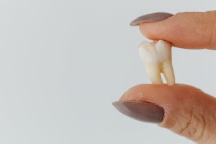 découvrez tout ce que vous devez savoir sur l'extraction des dents de sagesse : des symptômes aux procédures, en passant par les soins postopératoires. informez-vous pour une intervention en toute sérénité.