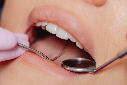 découvrez des conseils et des informations essentielles pour maintenir une santé gingivale optimale. apprenez les meilleures pratiques pour prévenir les maladies des gencives et contribuer à un sourire éclatant.