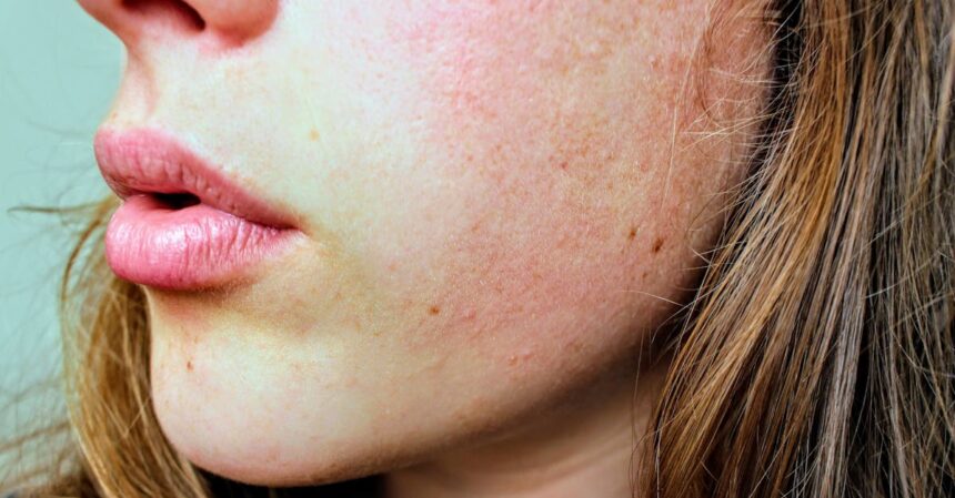 découvrez des conseils et astuces efficaces pour prendre soin de votre peau grasse. apprenez à choisir les bons produits, adopter une routine adaptée et maîtriser la brillance tout en améliorant votre teint.