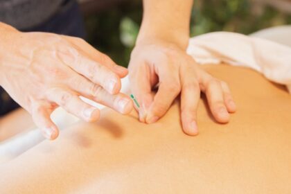 découvrez les bienfaits de l'acupuncture, une médecine traditionnelle qui utilise des aiguilles pour soulager la douleur, améliorer le bien-être et favoriser la guérison naturelle. explorez cette pratique millénaire et ses applications variées pour un équilibre corps-esprit.