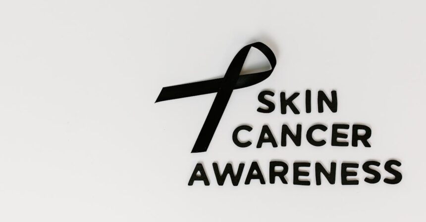 découvrez tout sur le cancer de la peau : causes, symptômes, prévention et traitements. informez-vous pour protéger votre santé et celle de vos proches.