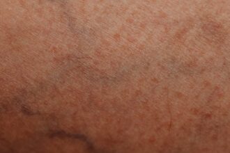 découvrez tout sur l'épiderme, la couche supérieure de la peau, essentielle pour la protection et la santé cutanée. apprenez ses fonctions, ses caractéristiques et comment en prendre soin au quotidien.