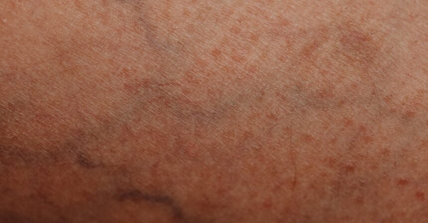 découvrez tout sur l'épiderme, la couche supérieure de la peau, essentielle pour la protection et la santé cutanée. apprenez ses fonctions, ses caractéristiques et comment en prendre soin au quotidien.