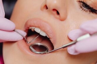 découvrez des conseils essentiels pour une hygiène bucco-dentaire optimale avec notre guide sur les soins dentaires. apprenez les meilleures pratiques pour maintenir des dents saines et un sourire éclatant.