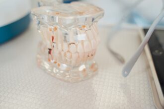 découvrez tout ce que vous devez savoir sur les lésions dentaires, leurs causes, symptômes et traitements. informez-vous sur les bonnes pratiques pour maintenir une santé bucco-dentaire optimale et prévenir les complications.