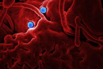 découvrez les causes, symptômes et traitements des maladies infectieuses. informez-vous sur la prévention et les dernières avancées en matière de recherche pour protéger votre santé et celle de vos proches.