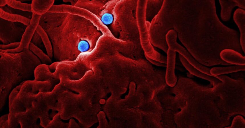 découvrez les causes, symptômes et traitements des maladies infectieuses. informez-vous sur la prévention et les dernières avancées en matière de recherche pour protéger votre santé et celle de vos proches.