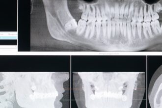 découvrez l'orthodontie, une spécialité dentaire visant à corriger les malpositions des dents et des mâchoires. obtenez des conseils d'experts sur les traitements, les appareils orthodontiques, et améliorez votre sourire tout en préservant votre santé bucco-dentaire.