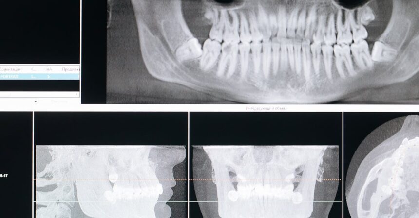 découvrez l'orthodontie, une spécialité dentaire visant à corriger les malpositions des dents et des mâchoires. obtenez des conseils d'experts sur les traitements, les appareils orthodontiques, et améliorez votre sourire tout en préservant votre santé bucco-dentaire.