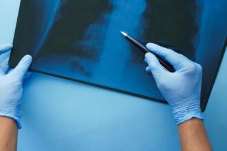 découvrez les pacemakers, des dispositifs médicaux essentiels pour réguler le rythme cardiaque. apprenez leur fonctionnement, les indications pour leur utilisation, ainsi que les avancées technologiques récentes dans le domaine de la cardiologie.