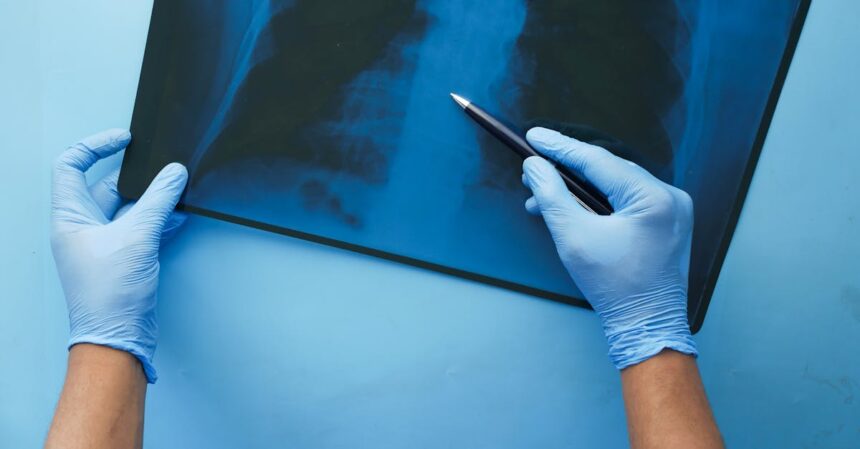 découvrez les pacemakers, des dispositifs médicaux essentiels pour réguler le rythme cardiaque. apprenez leur fonctionnement, les indications pour leur utilisation, ainsi que les avancées technologiques récentes dans le domaine de la cardiologie.
