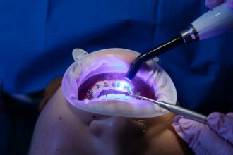 découvrez nos solutions efficaces pour le blanchiment dentaire et offrez-vous un sourire éclatant ! des produits sûrs et faciles à utiliser pour une blancheur éclatante en toute confiance.