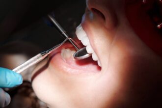 découvrez l'importance de la santé bucco-dentaire pour votre bien-être général. apprenez des conseils pratiques pour maintenir une bonne hygiène dentaire, prévenir les caries et les maladies des gencives, et garder un sourire éclatant.