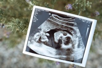découvrez tout sur l'échographie : son fonctionnement, ses applications médicales et ses bienfaits dans le diagnostic et le suivi de la santé. apprenez comment cette technologie non invasive aide à visualiser les organes internes et à surveiller la grossesse.
