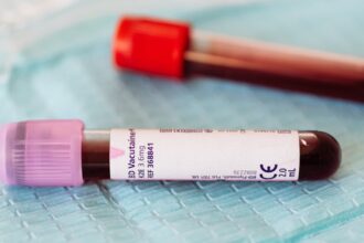 découvrez l'importance des tests sanguins pour votre santé. informations sur les types de tests, leur procédure et les résultats attendus pour une meilleure compréhension de votre bien-être.
