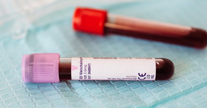 découvrez l'importance des tests sanguins pour votre santé. informations sur les types de tests, leur procédure et les résultats attendus pour une meilleure compréhension de votre bien-être.