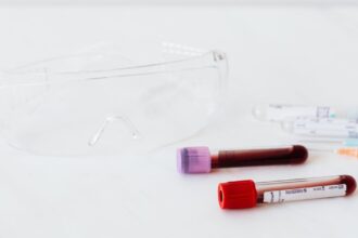 découvrez l'importance des analyses de sang dans le diagnostic et le suivi de votre santé. informez-vous sur les différents types de tests sanguins, leur préparation et leurs résultats.