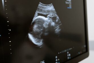 découvrez les prix des tests de grossesse pour choisir celui qui correspond le mieux à vos besoins. comparez les options disponibles et trouvez un test fiable à un prix abordable.