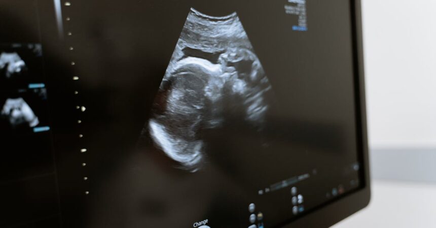découvrez les prix des tests de grossesse pour choisir celui qui correspond le mieux à vos besoins. comparez les options disponibles et trouvez un test fiable à un prix abordable.