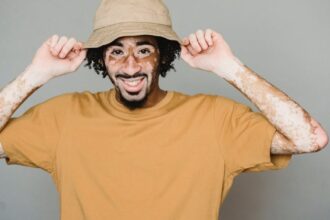 découvrez tout sur le psoriasis, une maladie inflammatoire de la peau qui provoque des plaques rouges et squameuses. apprenez les causes, les symptômes et les traitements disponibles pour mieux gérer cette condition et améliorer votre qualité de vie.