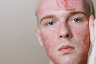 découvrez nos astuces incontournables pour obtenir une peau éclatante et radieuse. apprenez à nourrir votre peau, à choisir les bons produits et à adopter des routines de beauté efficaces pour un teint lumineux. transformez votre routine et révélez votre éclat naturel!