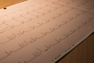 découvrez les clés d'une bonne santé cardiovasculaire : conseils, aliments bénéfiques et exercices pour protéger votre cœur et améliorer votre bien-être général.