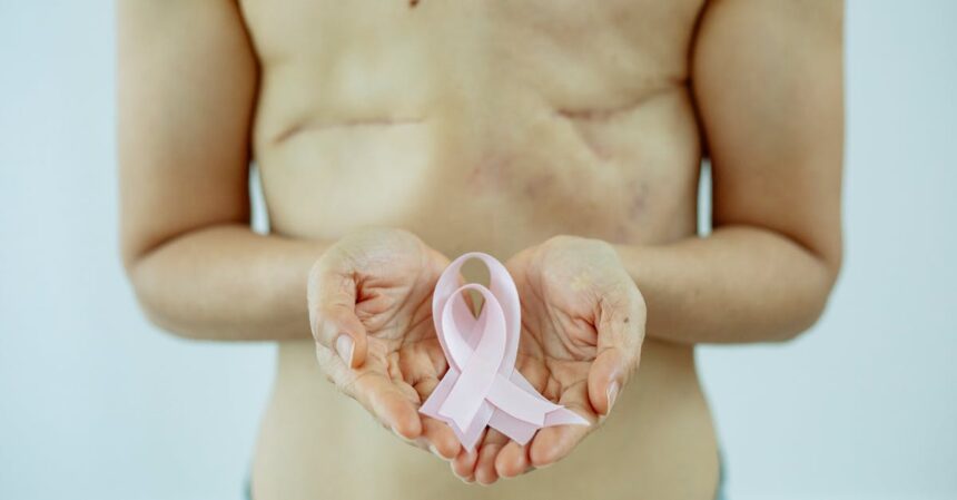 découvrez le concept de survivorship, son importance dans les études de santé, et comment il influence la recherche sur le cancer ainsi que l’expérience des survivants. explorez les défis et les ressources disponibles pour ceux qui ont surmonté la maladie.