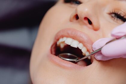 découvrez nos conseils et produits essentiels pour prendre soin de vos gencives. apprenez comment maintenir une bonne hygiène bucco-dentaire et prévenir les problèmes liés aux gencives pour un sourire sain et éclatant.