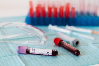 découvrez l'importance des tests sanguins pour votre santé. informez-vous sur les différents types d'analyses, leurs objectifs et comment ils peuvent aider à diagnostiquer des maladies.