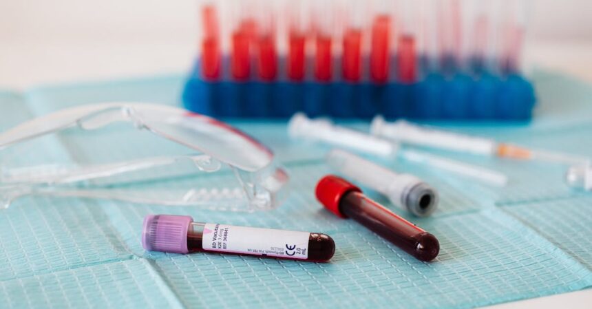 découvrez l'importance des tests sanguins pour votre santé. informez-vous sur les différents types d'analyses, leurs objectifs et comment ils peuvent aider à diagnostiquer des maladies.